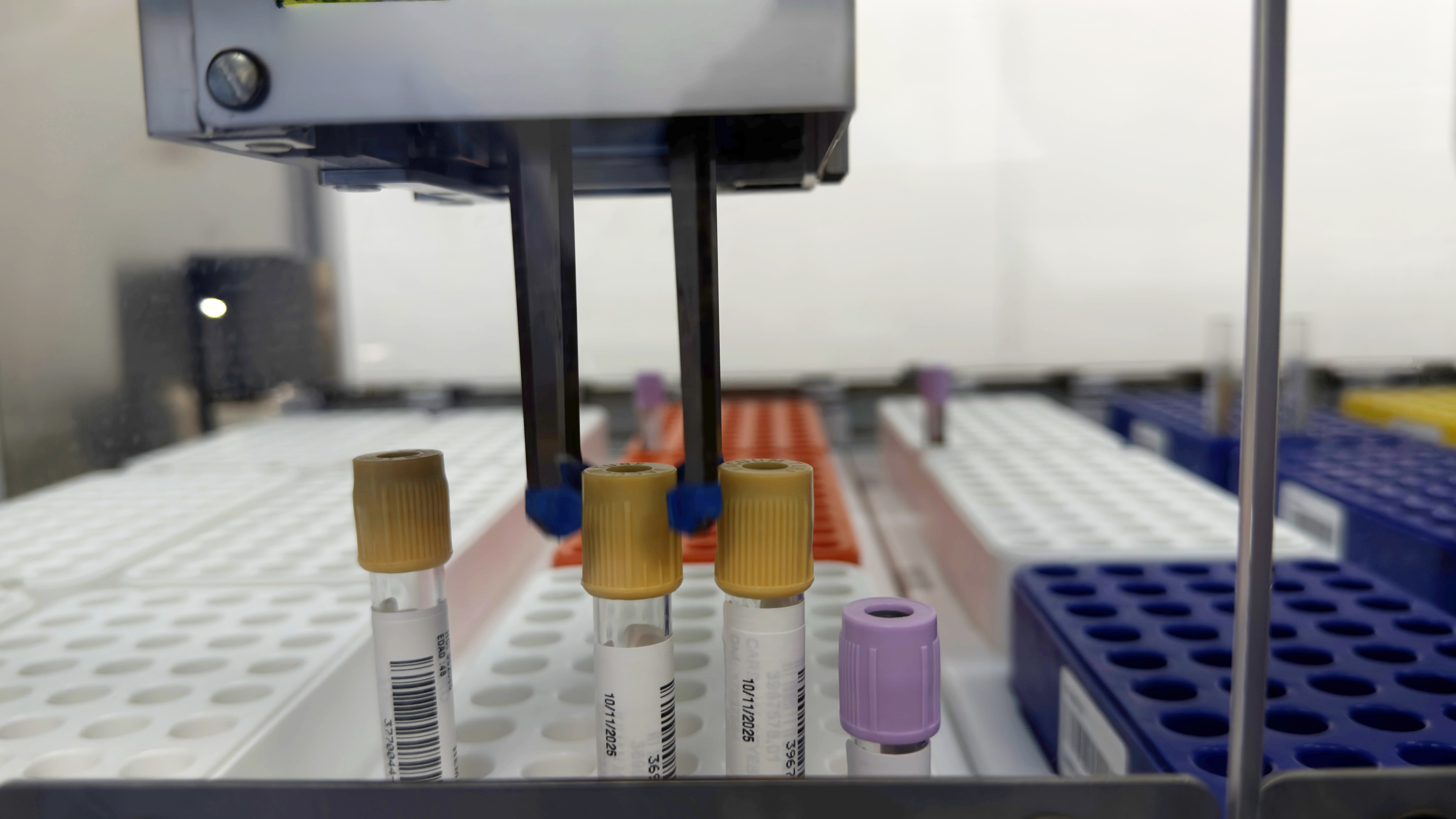 EsSalud: Nuevo laboratorio del hospital Almenara con sistema robótico permitirá realizar hasta 40 mil atenciones mensuales