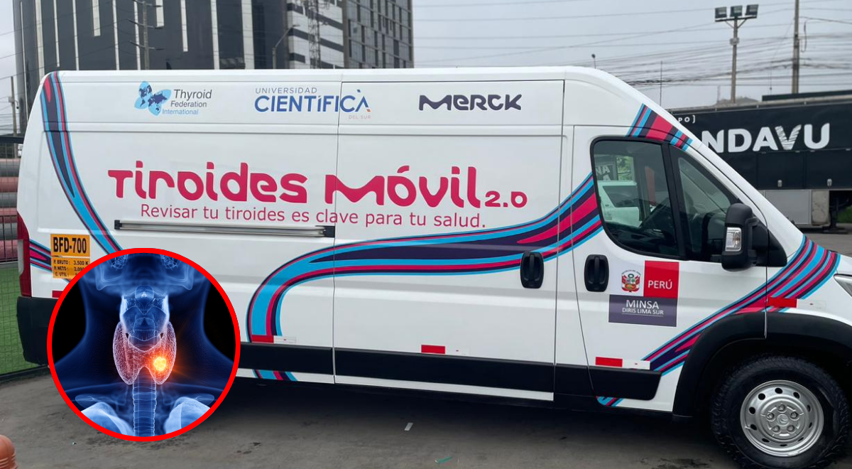 “Tiroides Móvil 2.0”, un proyecto que por segunda vez recorre el Perú para cuidar la salud de los más vulnerables