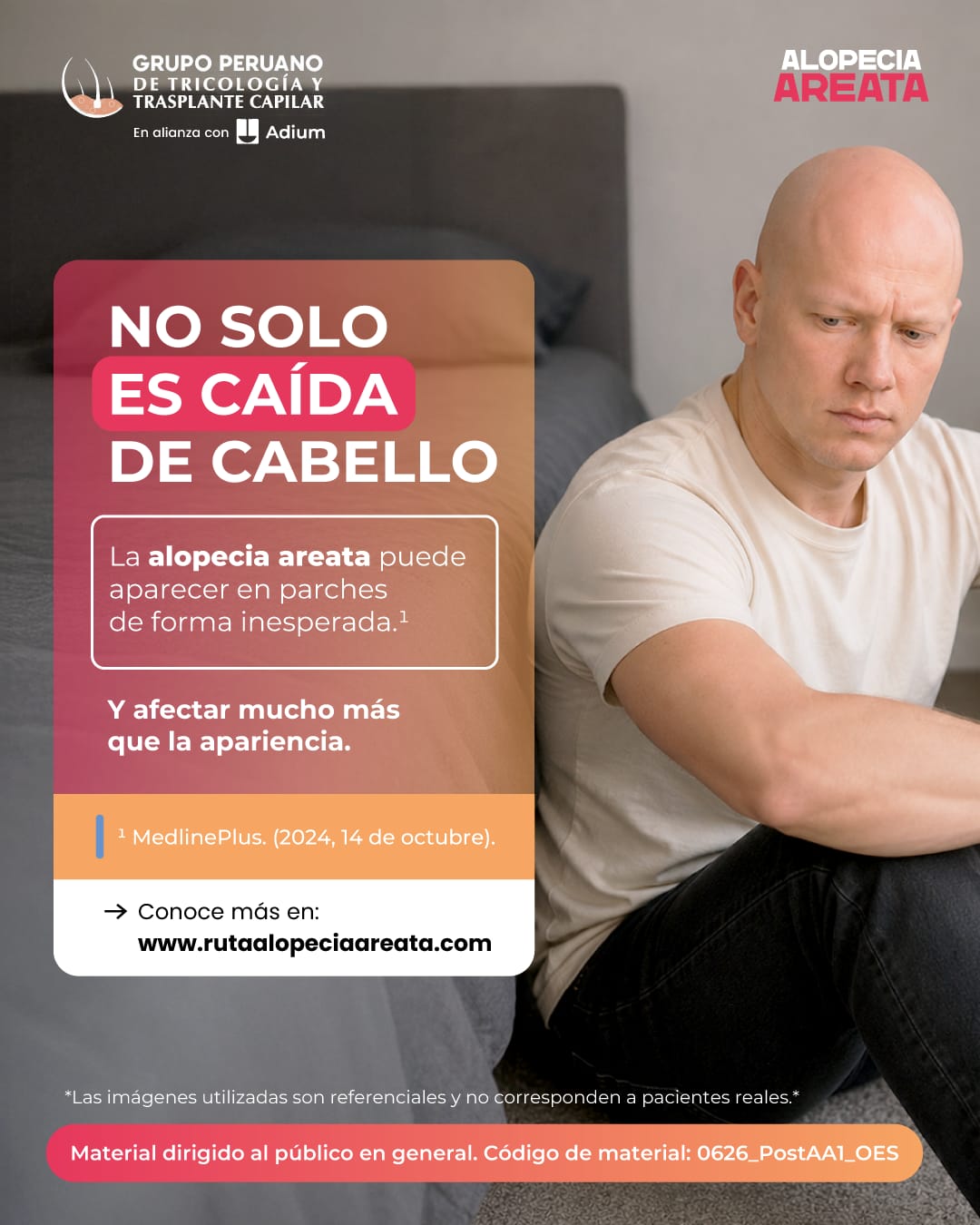 Caída de cabello en parches: la señal que podría alertar sobre Alopecia Areata