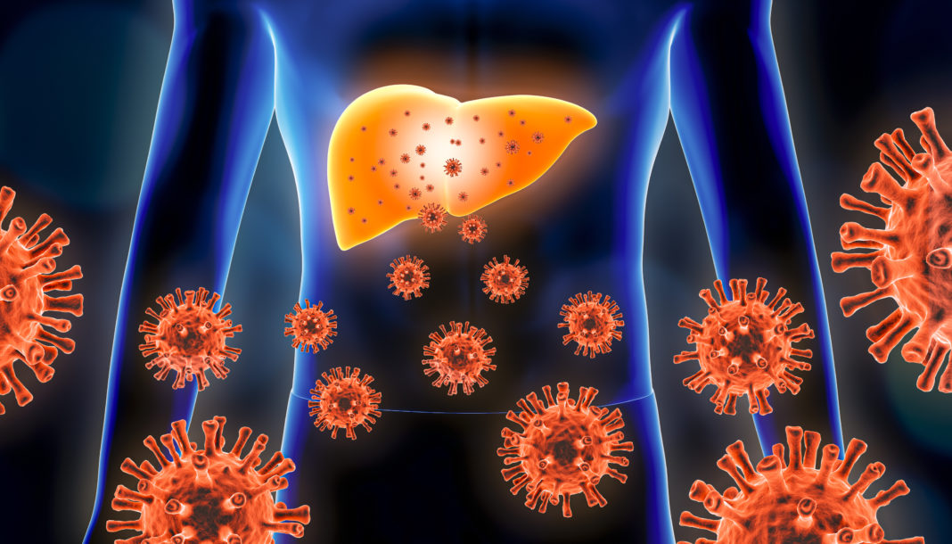 Hepatitis: la infección que avanza en silencio y puede ser mortal