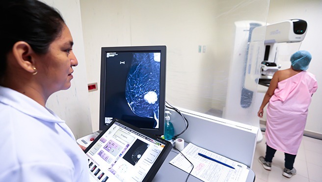 Ministerio de Salud realizó tamizajes de cáncer de mama a más de 613 mil mujeres hasta el tercer trimestre del 2026
