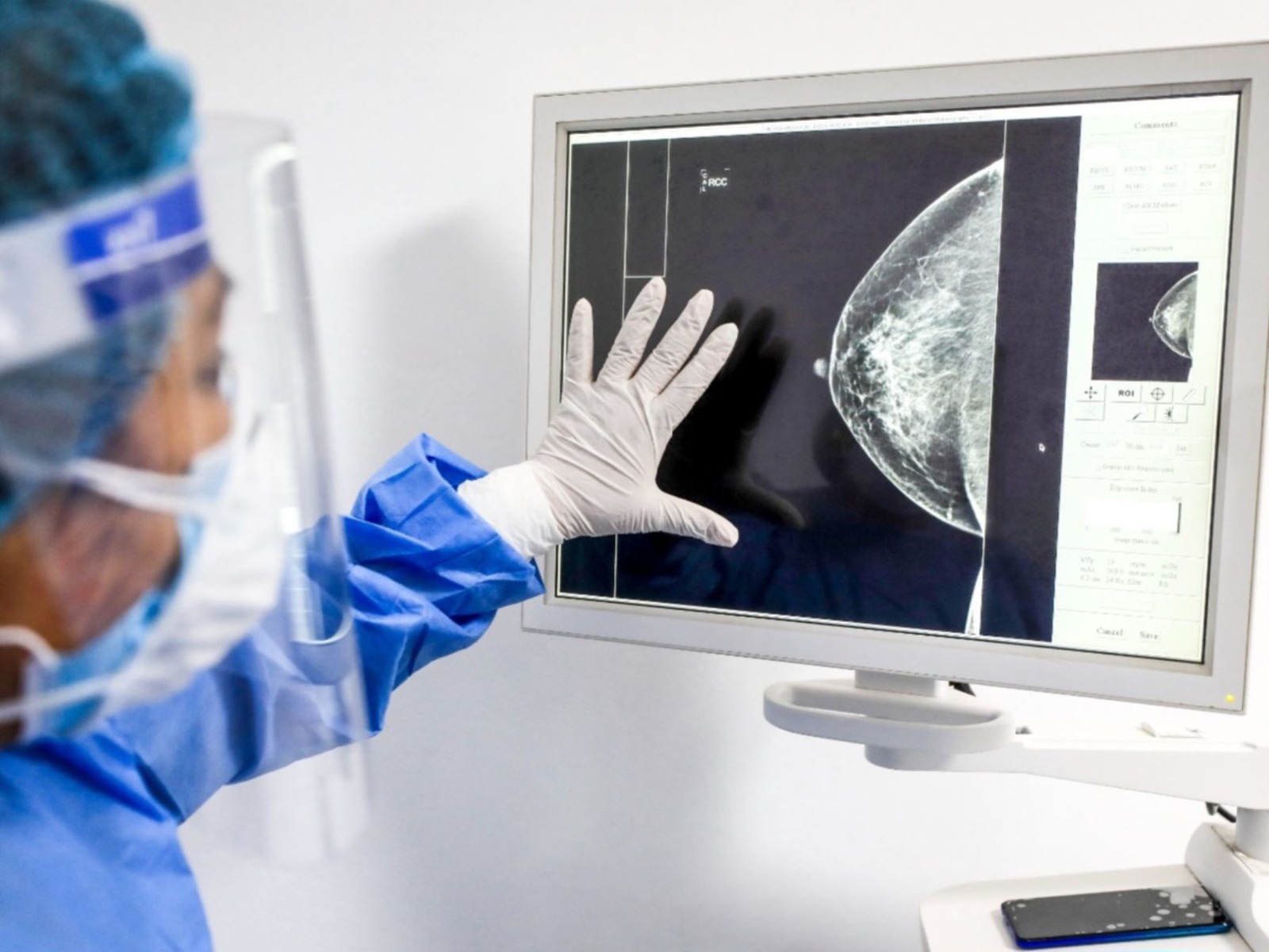 ¿Por qué el cáncer hace metástasis? El proceso detrás de la expansión tumoral