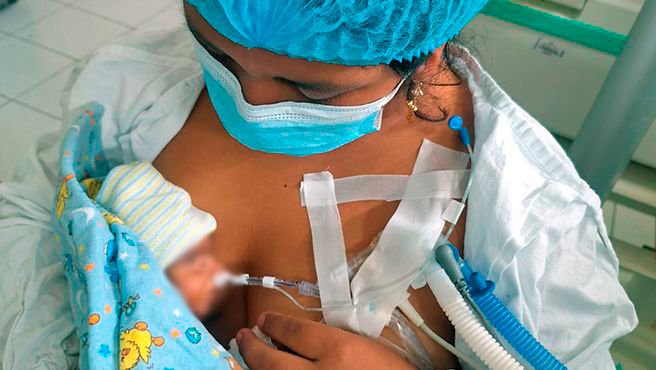 Hospital Carlos Lanfranco La Hoz logra proeza médica atendiendo a bebé prematura de 690 gramos tras exitosa intervención de emergencia