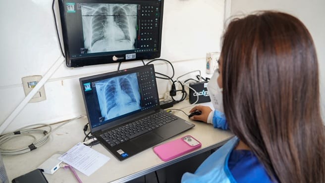 Minsa realiza tamizaje a más de 6,000 trabajadores de salud para detectar tuberculosis y cáncer de pulmón