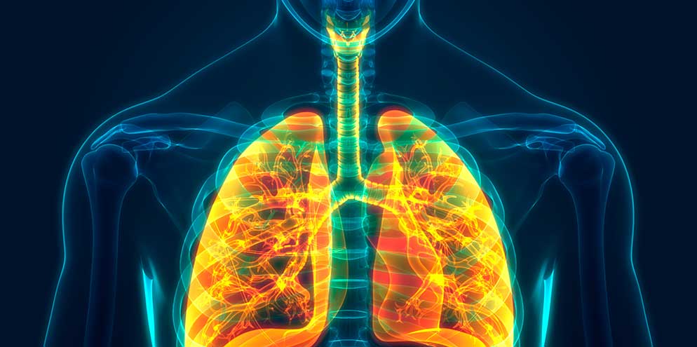 Diferencias entre neumonía, gripe y bronquitis: Cómo identificarlas a tiempo puede salvar vidas