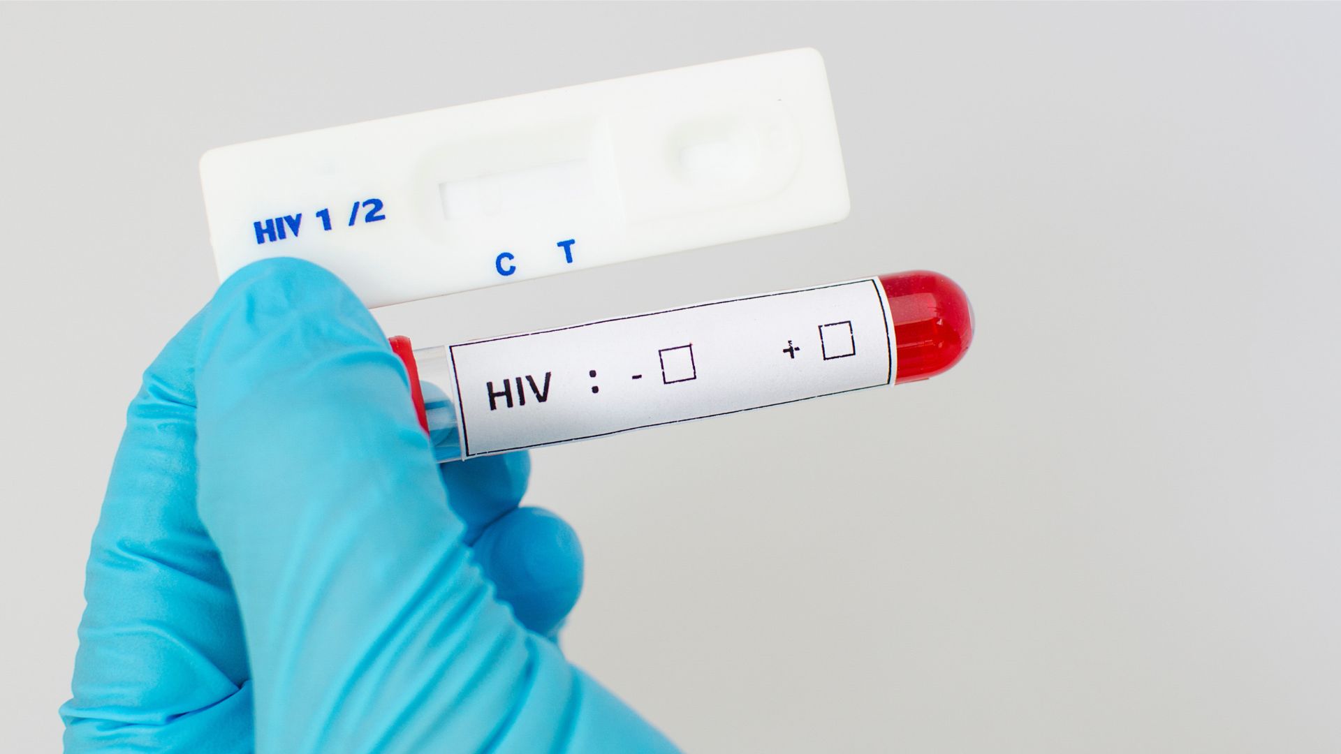 Una nueva alternativa para la detección temprana del VIH llega al Perú