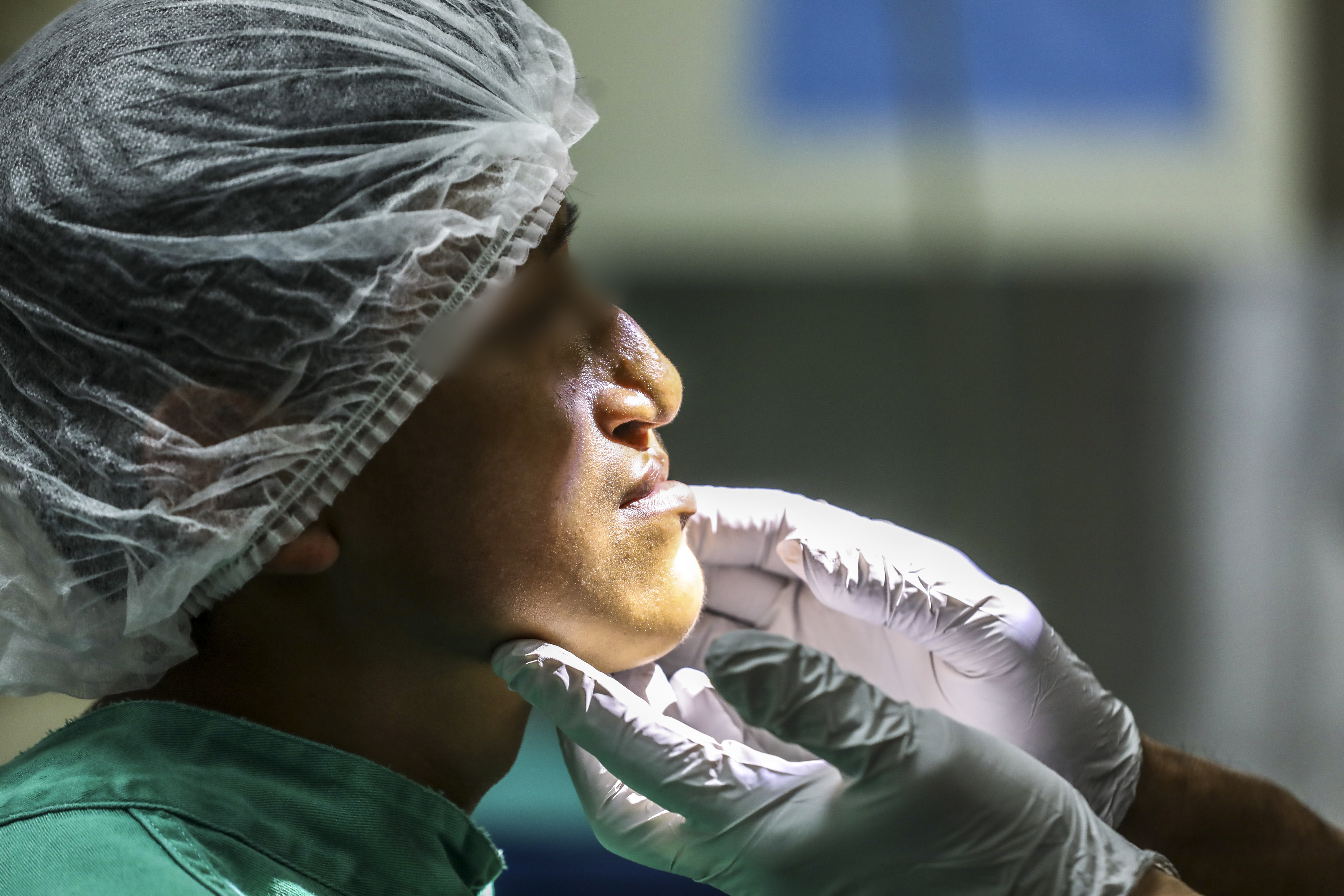 Cirugías que cambian vidas: EsSalud y Operación Sonrisa llegan a Piura con campaña gratuita