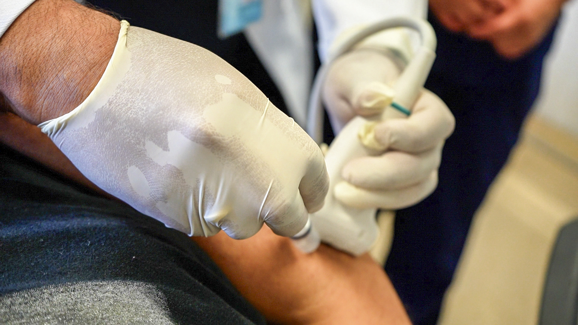 Hospital Almenara incorpora ecógrafo de alta precisión para más de 400 procedimientos mensuales