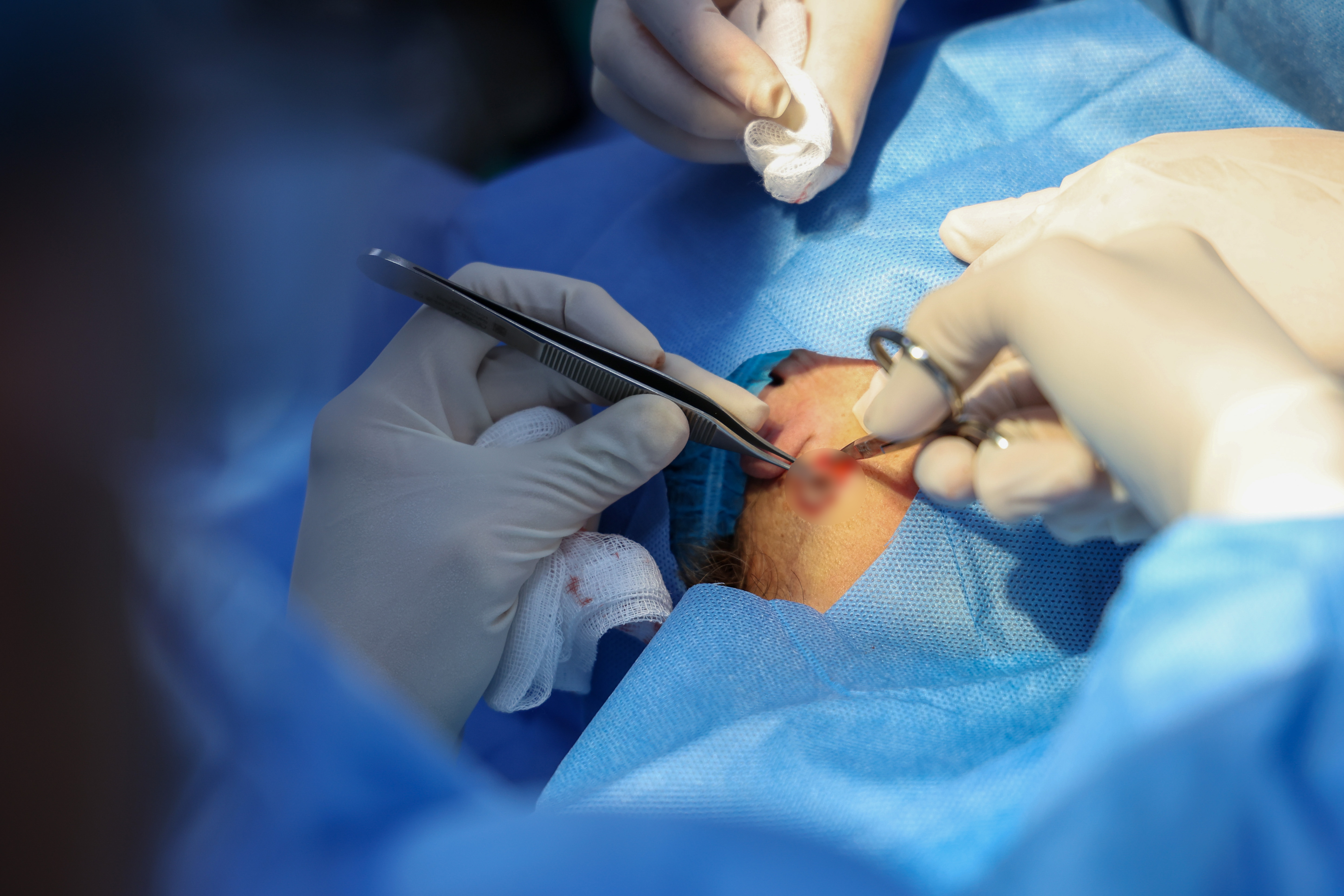 Hospital Rebagliati de EsSalud cuenta con moderna sala quirúrgica para extirpación de cáncer de piel