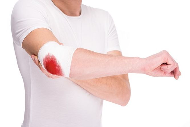 Hemofilia : Más del 50% de las mujeres con trastornos de coagulación desconoce su condición