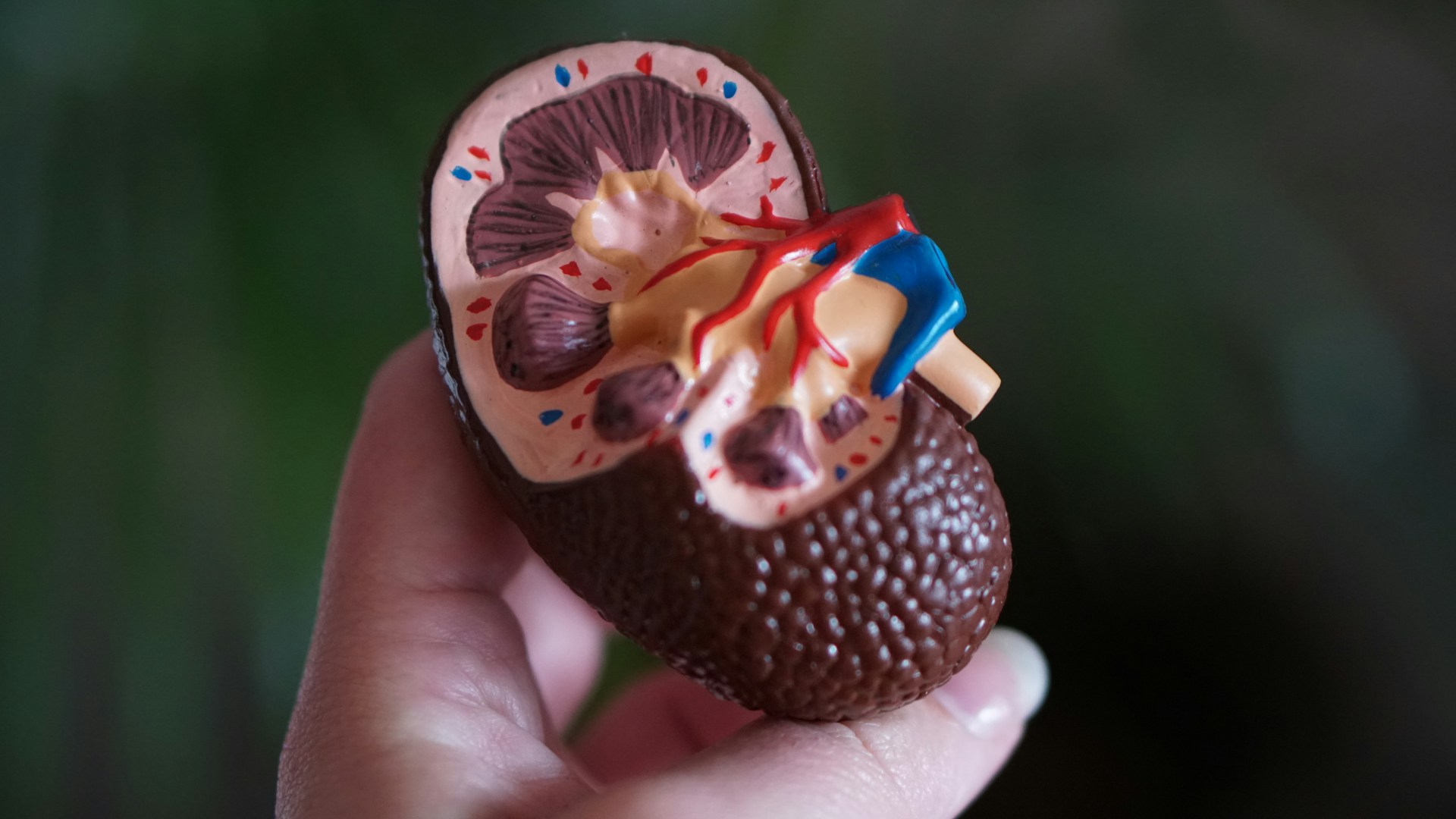 1 de cada 10 adultos en Perú padece una enfermedad renal crónica