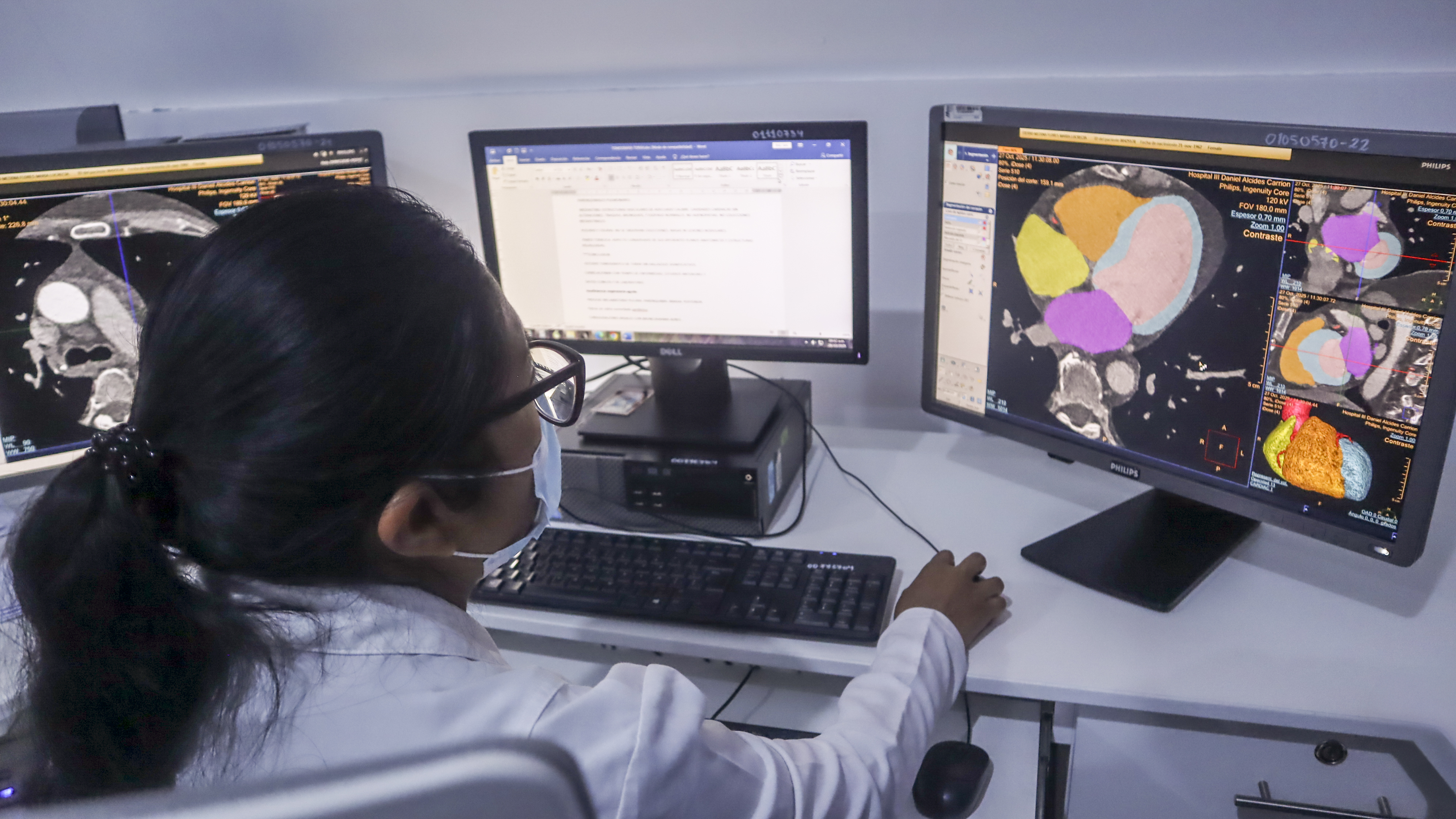 EsSalud: Especialistas del INCOR llevan atención cardiovascular de alta complejidad a Tacna