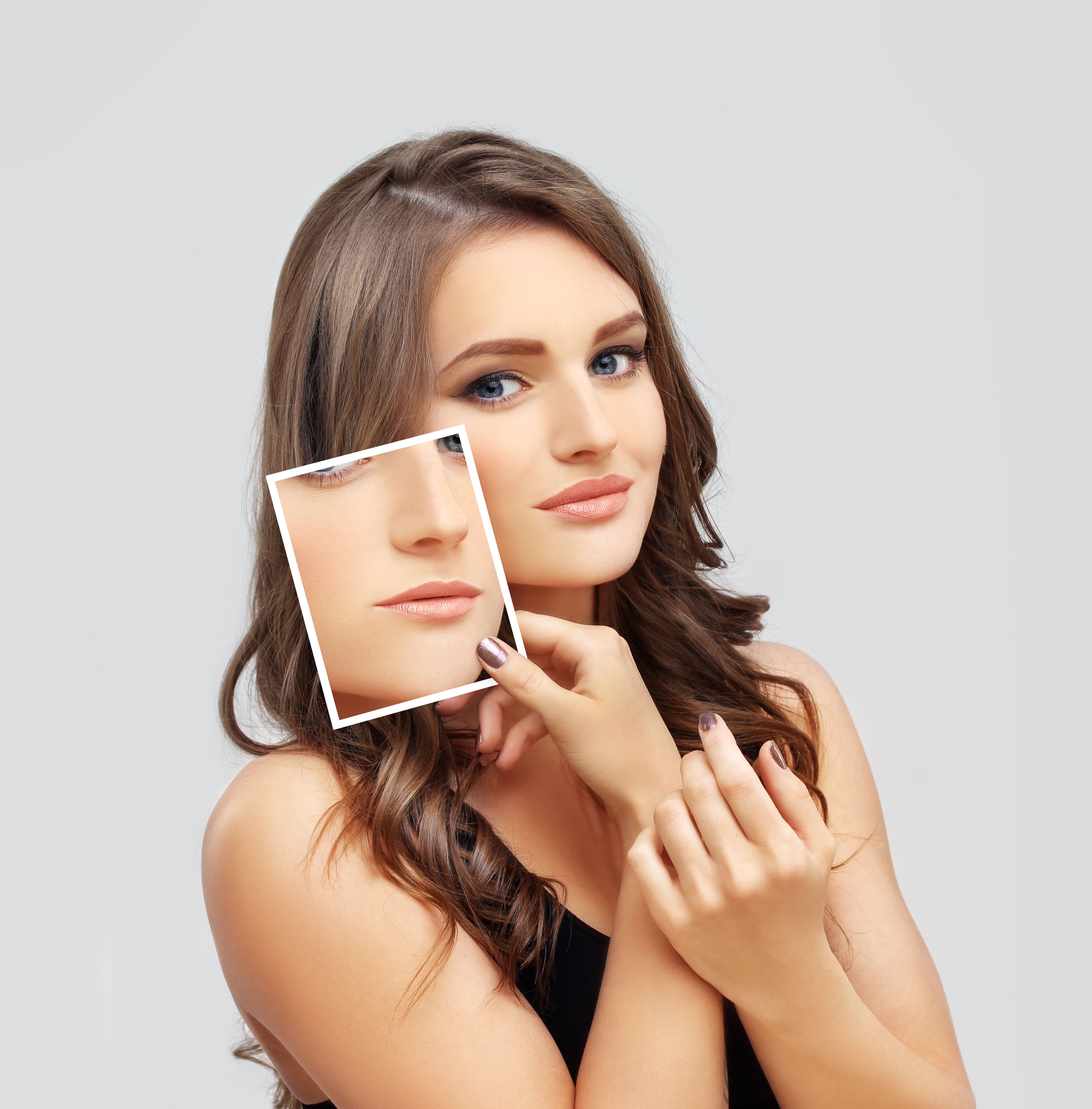 Ácido hialurónico en labios: ¿natural o voluminoso?