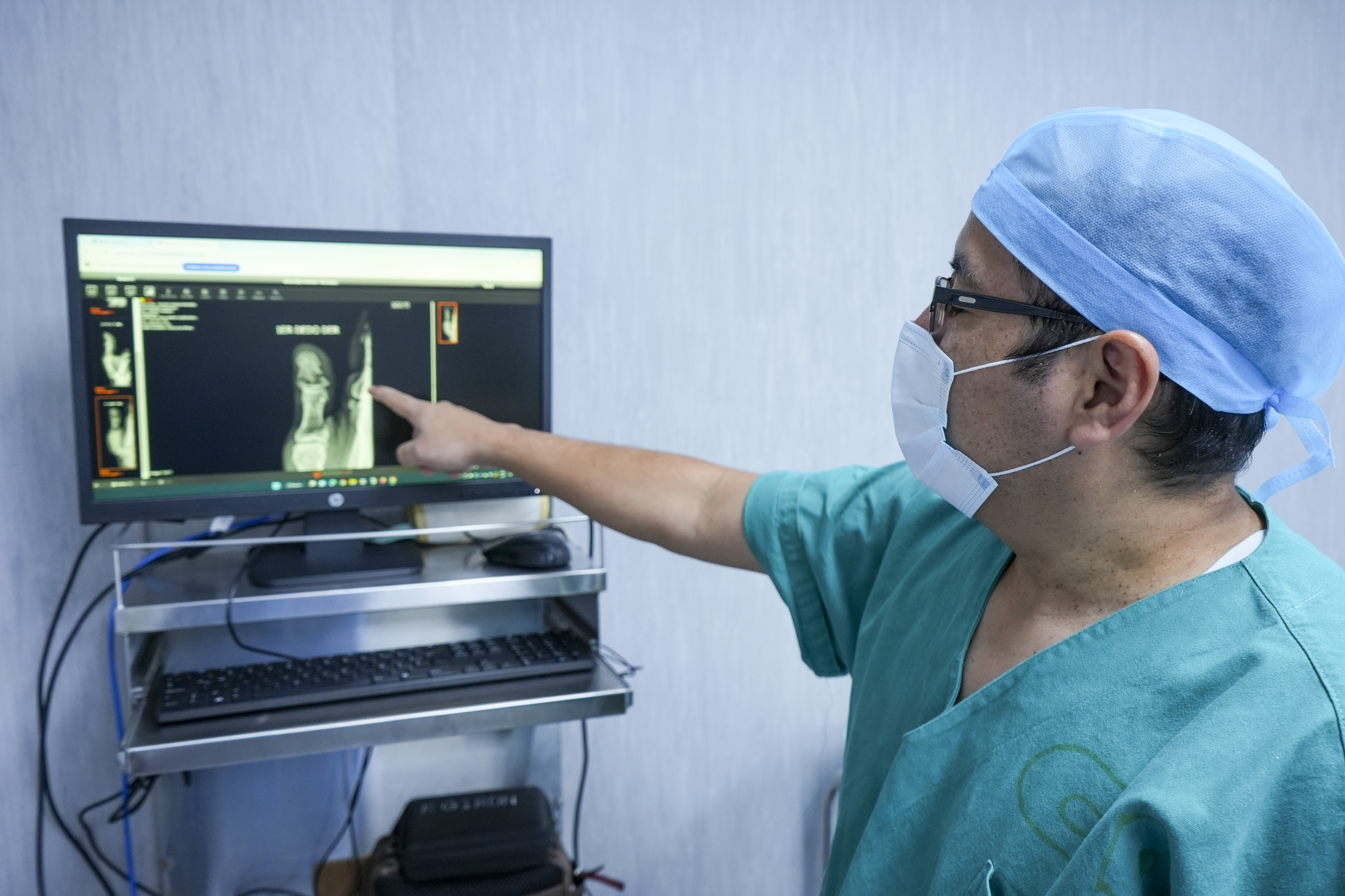 Proeza médica en EsSalud: Vladimir recuperó la alegría tras someterse a exitoso autotrasplante de dedo del pie a la mano