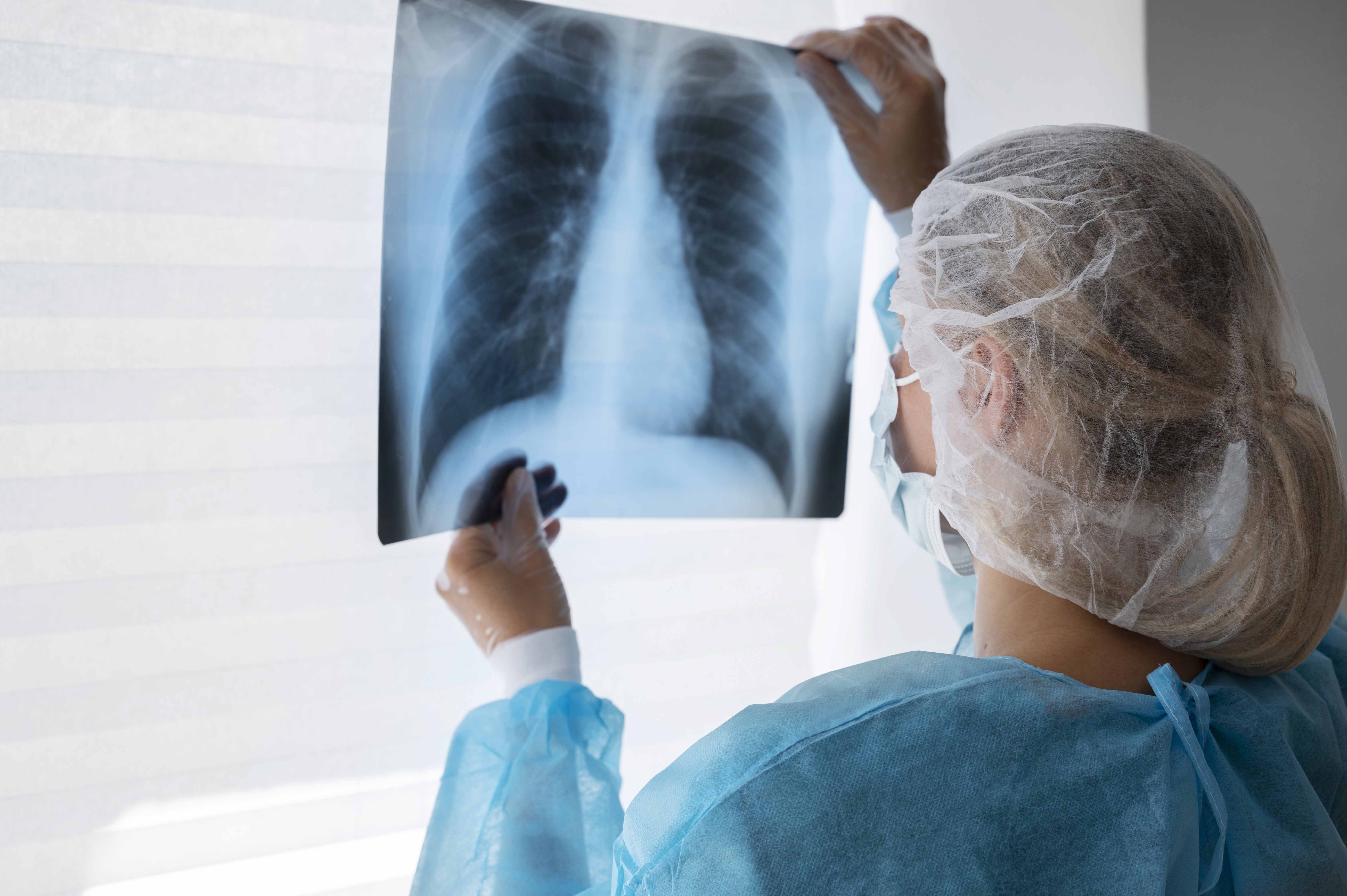 Niños representan cerca del 7% de cáncer por sarcoma