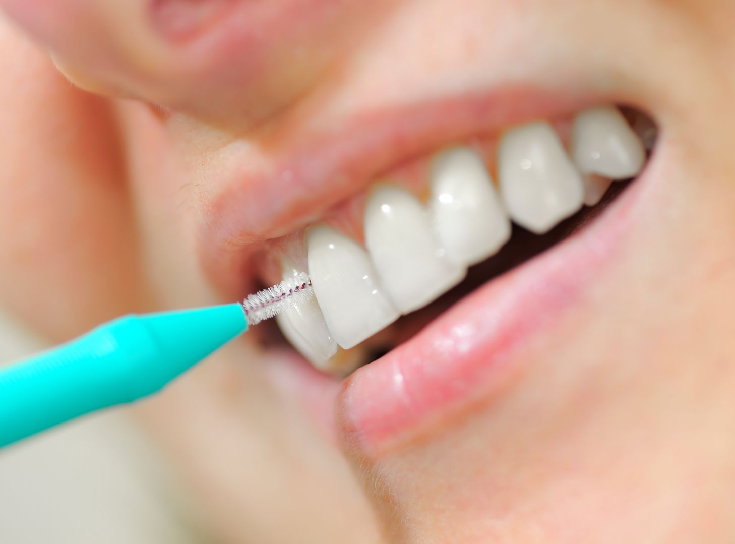 Cepillos interproximales: cómo usarlos y elegir el tamaño correcto