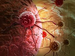 Cáncer en Latinoamérica: Un desafío único que requiere acción regional