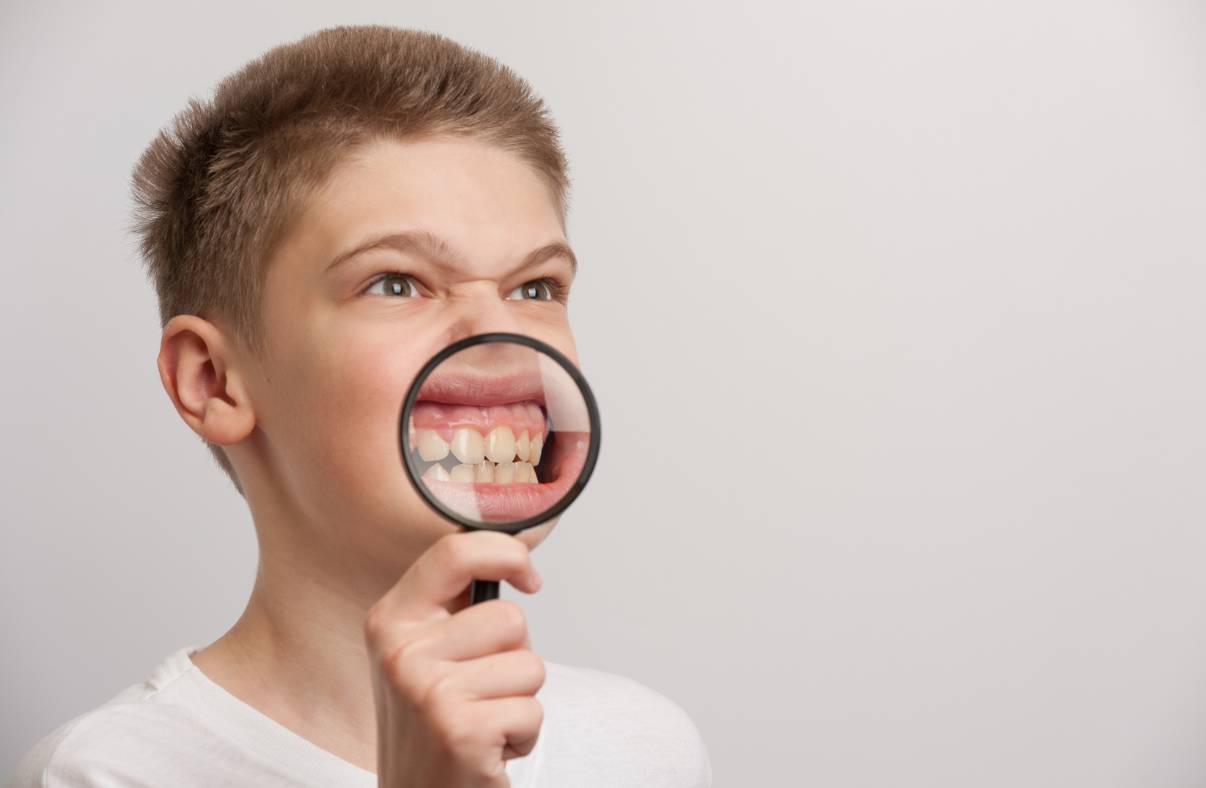Día del Niño: Conoce estas tres enfermedades bucales más comunes en niños