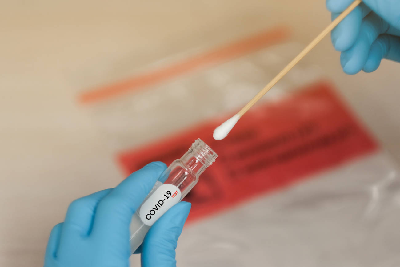 Variante Ómicron: Tres momentos claves para realizarse la prueba de Covid-19