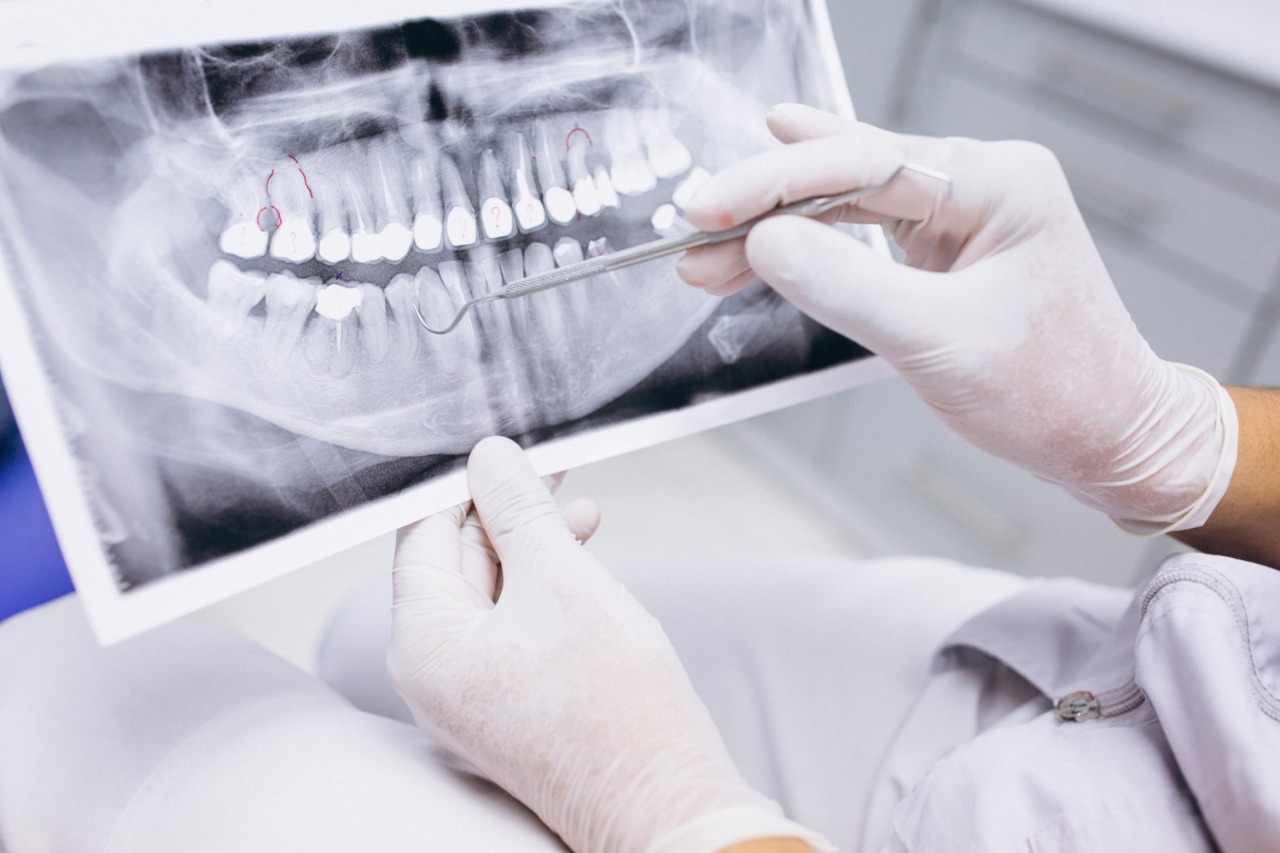 ¿Cómo saber a qué especialidad odontológica acudir?