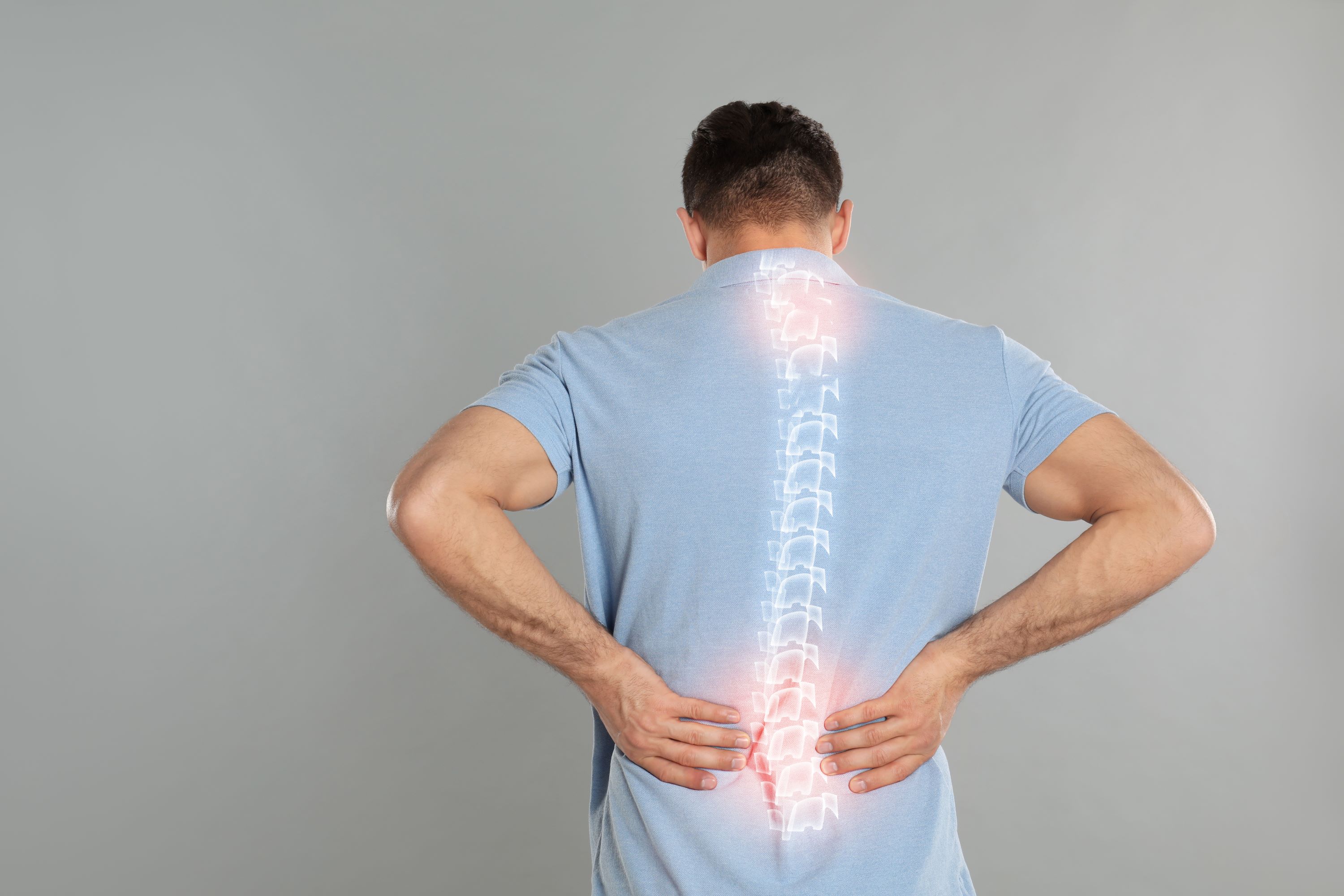 ¿Dolor de espalda después de una caída? Puede ser una fractura vertebral