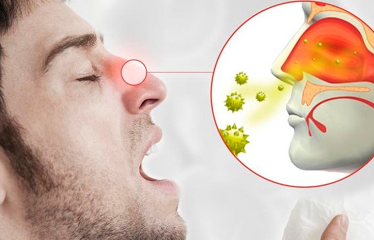 Guía práctica: Cómo protegerte, a ti y a tu familia, de alergias y virus en esta temporada de frío