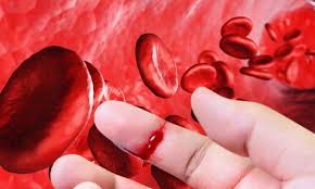 Un antes y un después en el manejo de la Hemofilia A: Nueva alternativa llega a Perú