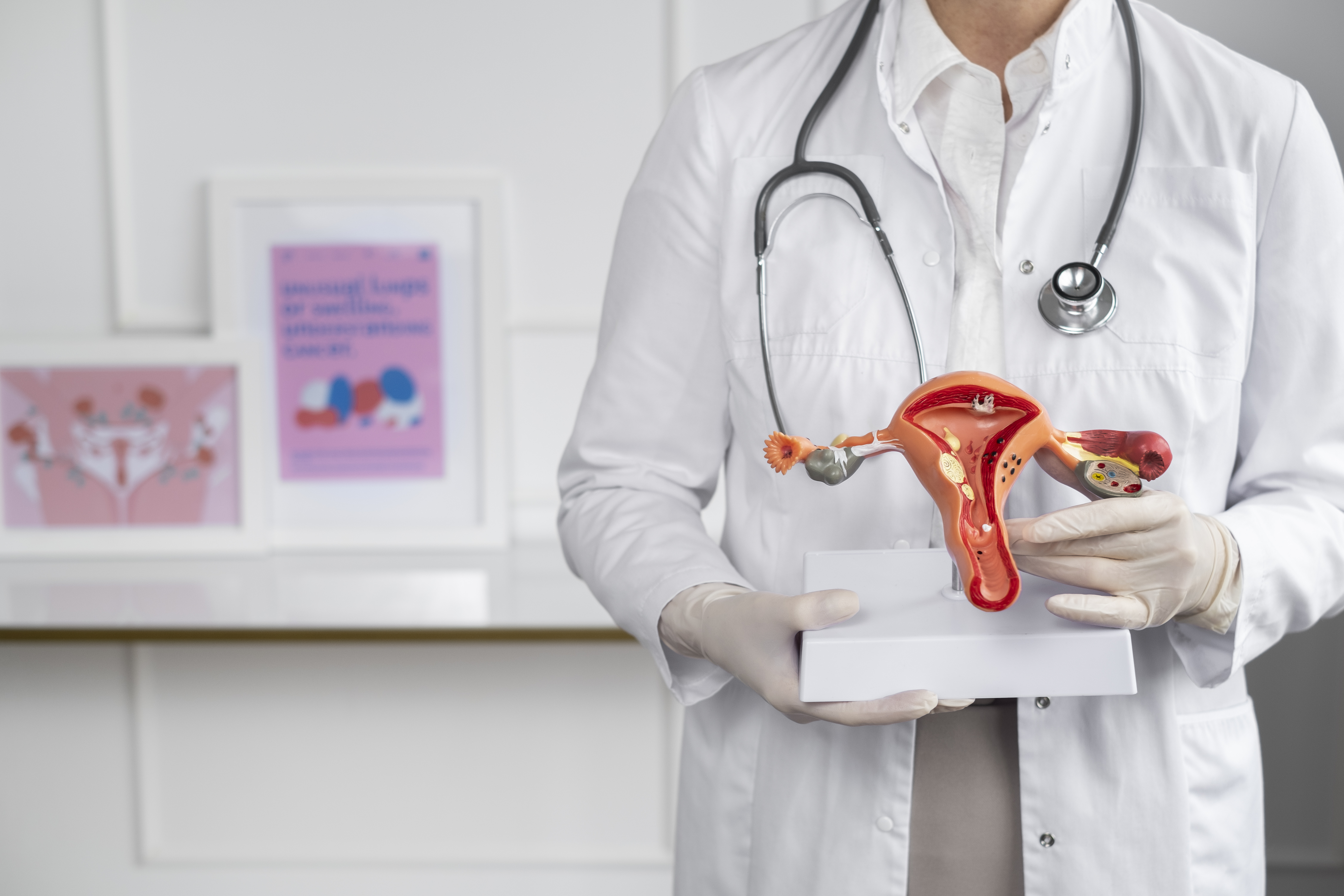 Chiclayo: Papanicolaou y prueba de VPH, las dos pruebas clave para detectar a tiempo el cáncer de cuello uterino