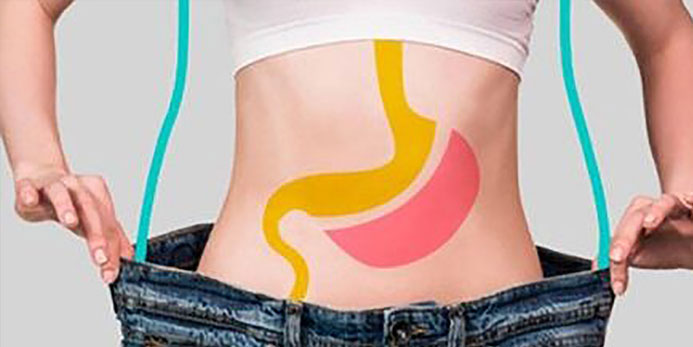 La cirugía bariátrica y el aumento de obesidad en el Perú.